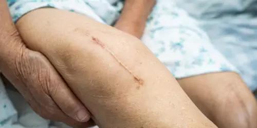 Struggling with scars from injuries or accidents?